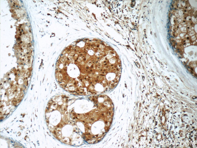 SNAPC5 Antibody in Immunohistochemistry (Paraffin) (IHC (P))