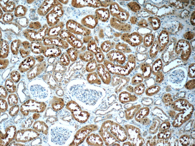 SNAPC5 Antibody in Immunohistochemistry (Paraffin) (IHC (P))