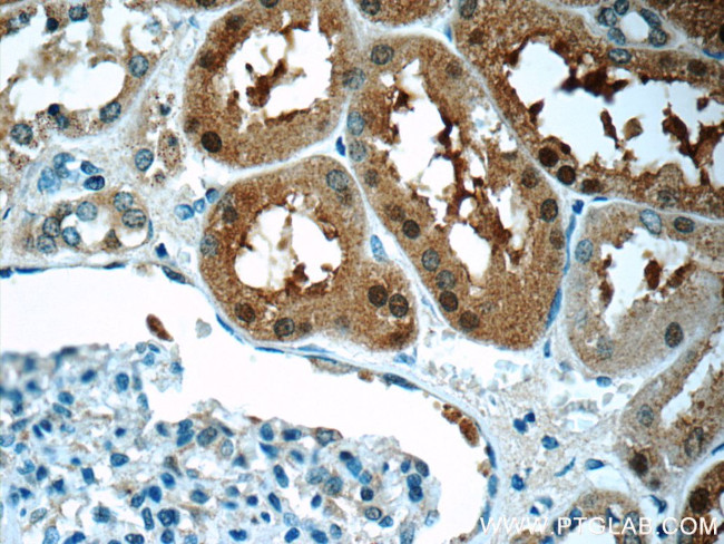 SNAPC5 Antibody in Immunohistochemistry (Paraffin) (IHC (P))