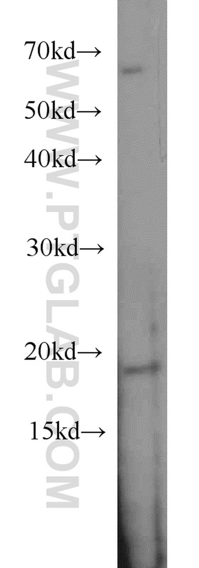 SNAPC5 Antibody in Western Blot (WB)