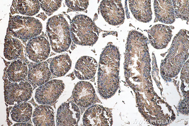 LARP2 Antibody in Immunohistochemistry (Paraffin) (IHC (P))