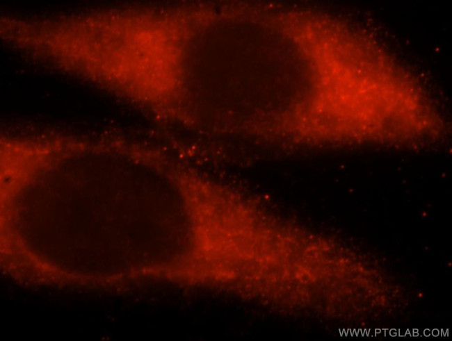 UBE2L6 Antibody in Immunocytochemistry (ICC/IF)