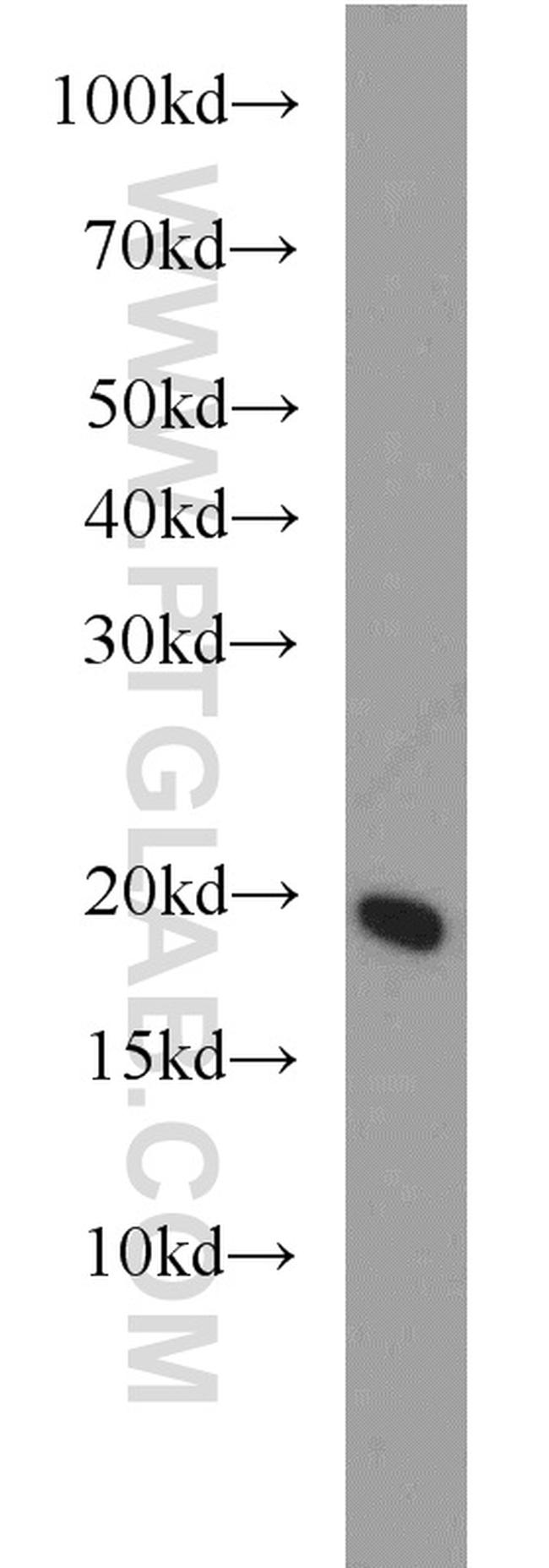 UBE2L6 Antibody in Western Blot (WB)