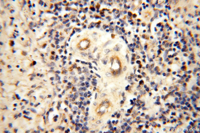 MRPS27 Antibody in Immunohistochemistry (Paraffin) (IHC (P))