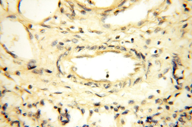 MRPS27 Antibody in Immunohistochemistry (Paraffin) (IHC (P))