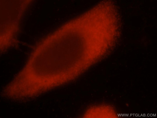 EIF4E3 Antibody in Immunocytochemistry (ICC/IF)