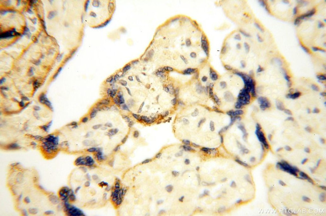 UBE2DNL Antibody in Immunohistochemistry (Paraffin) (IHC (P))