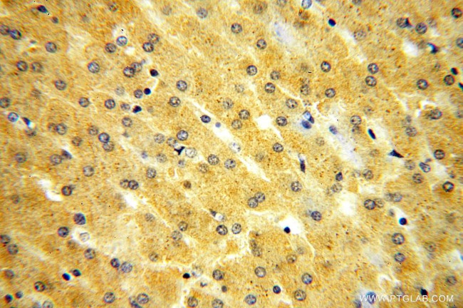 KIF6 Antibody in Immunohistochemistry (Paraffin) (IHC (P))