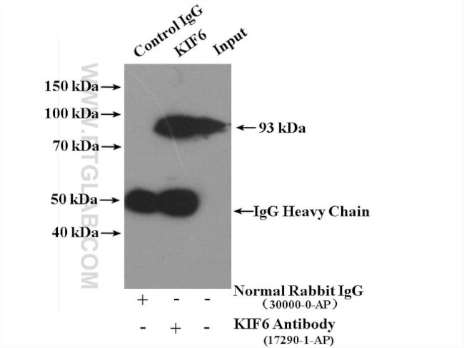 KIF6 Antibody in Immunoprecipitation (IP)