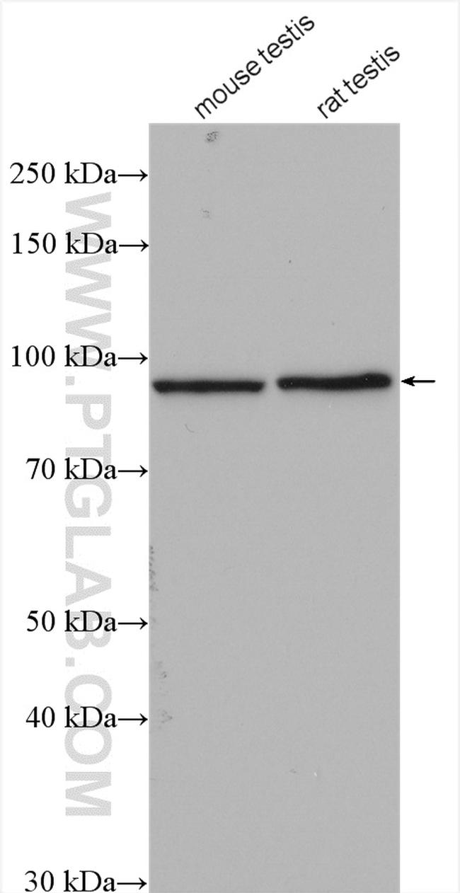 KIF6 Antibody in Western Blot (WB)