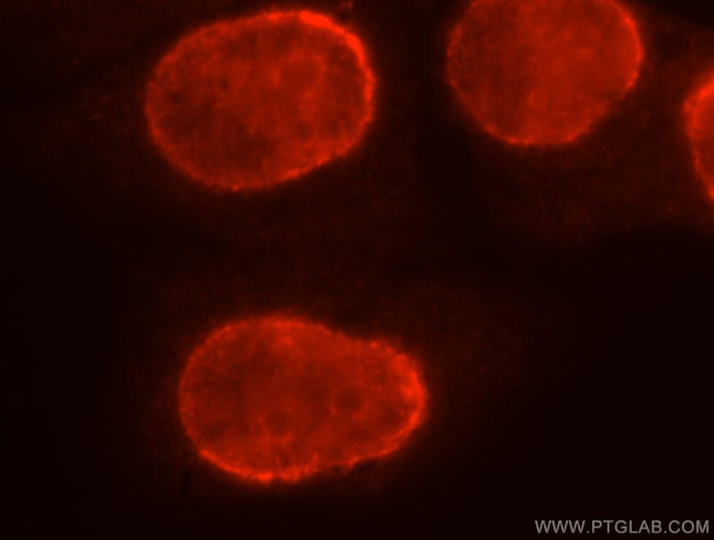 BXDC2 Antibody in Immunocytochemistry (ICC/IF)