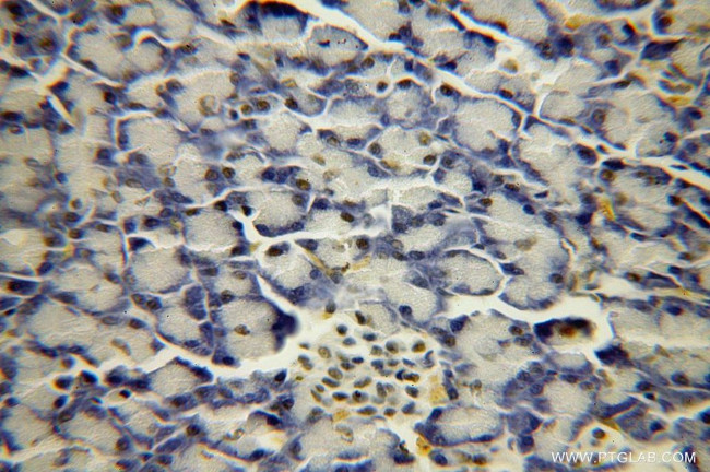 BXDC2 Antibody in Immunohistochemistry (Paraffin) (IHC (P))