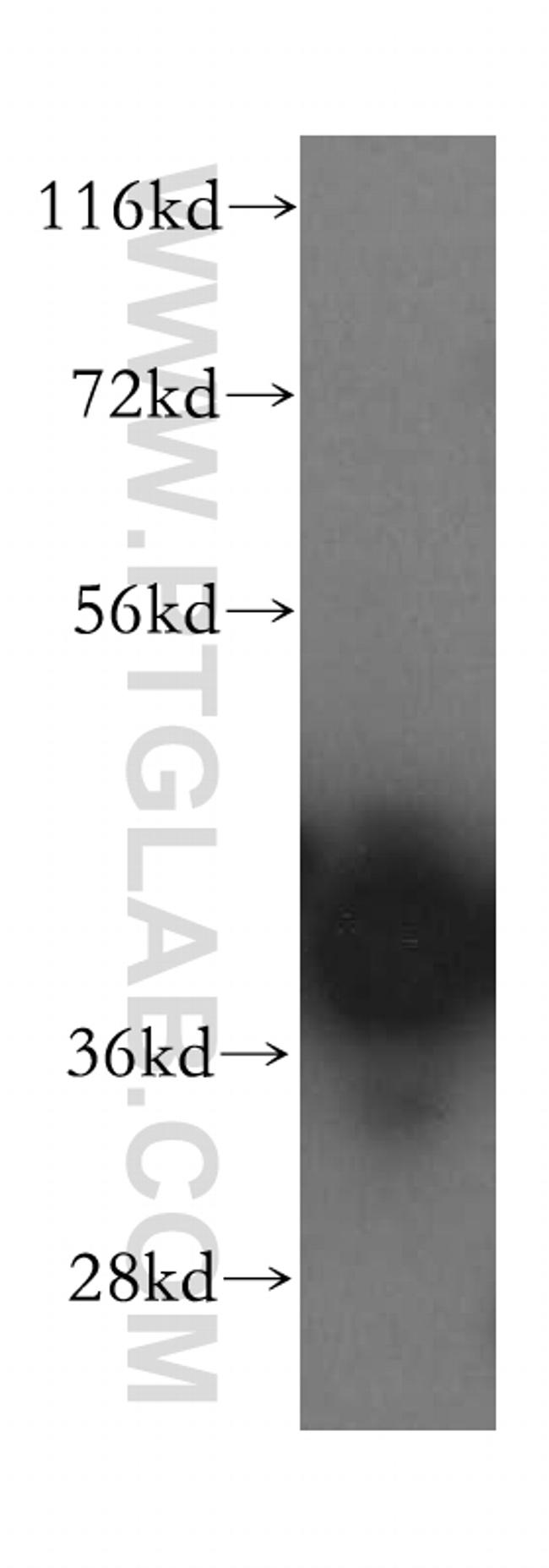 BXDC2 Antibody in Western Blot (WB)