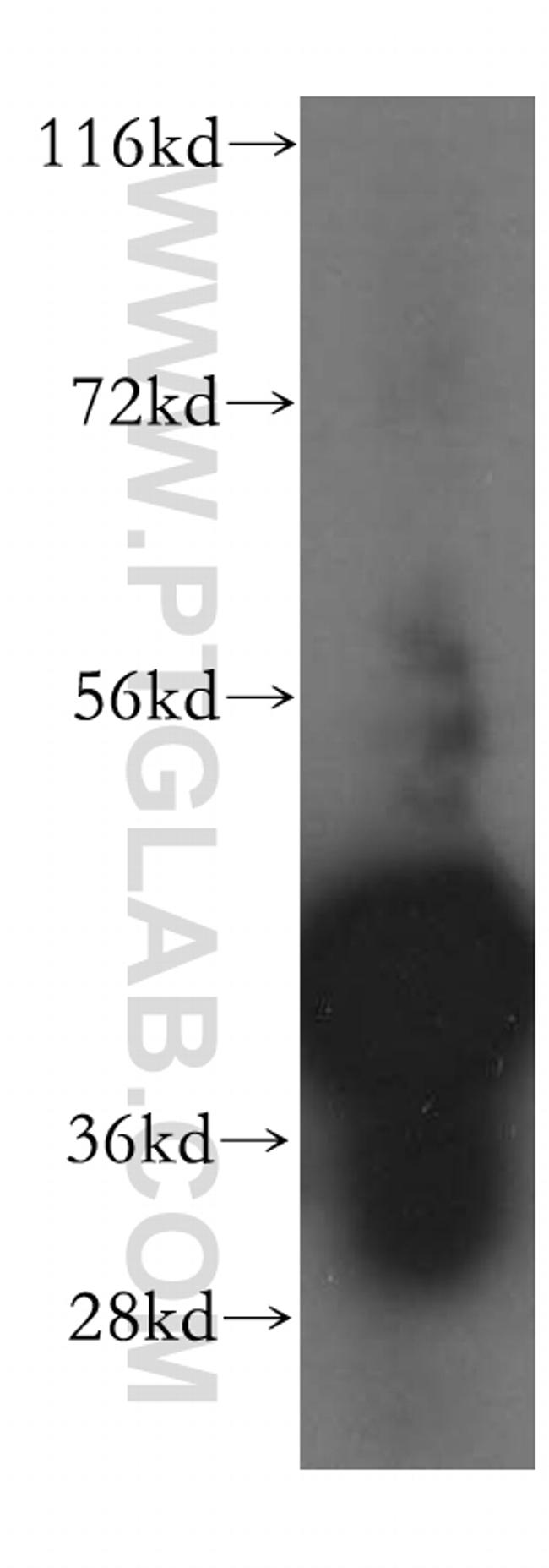 BXDC2 Antibody in Western Blot (WB)