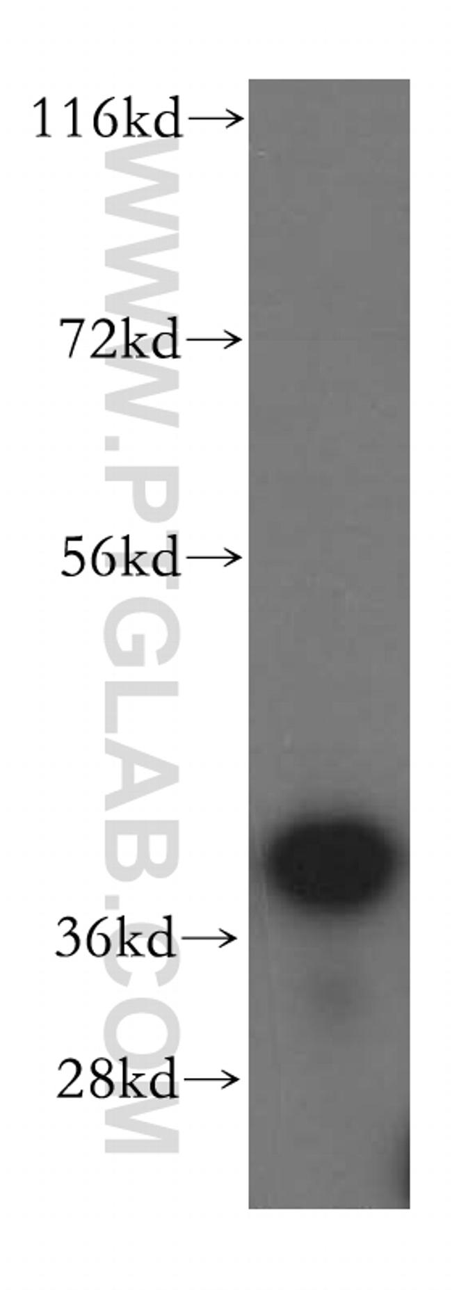 BXDC2 Antibody in Western Blot (WB)