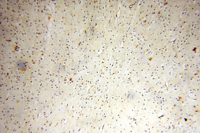 HSD17B11 Antibody in Immunohistochemistry (Paraffin) (IHC (P))