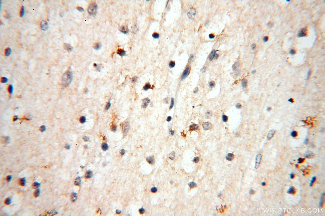 HSD17B11 Antibody in Immunohistochemistry (Paraffin) (IHC (P))