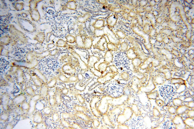 HSD17B11 Antibody in Immunohistochemistry (Paraffin) (IHC (P))