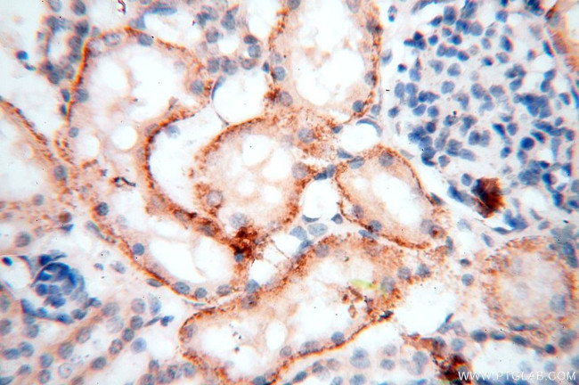 HSD17B11 Antibody in Immunohistochemistry (Paraffin) (IHC (P))