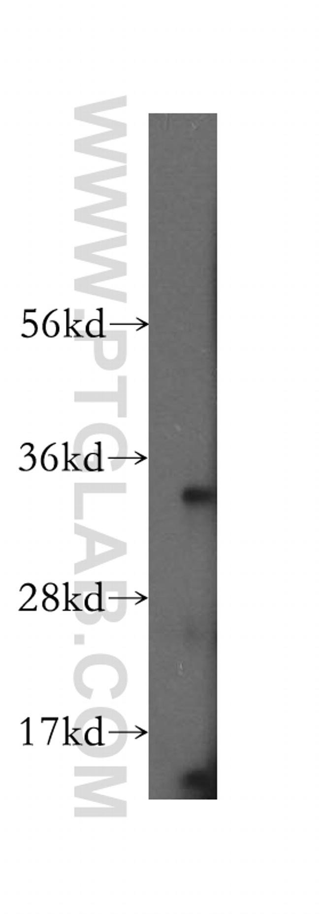 HSD17B11 Antibody in Western Blot (WB)