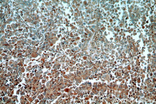 TGDS Antibody in Immunohistochemistry (Paraffin) (IHC (P))