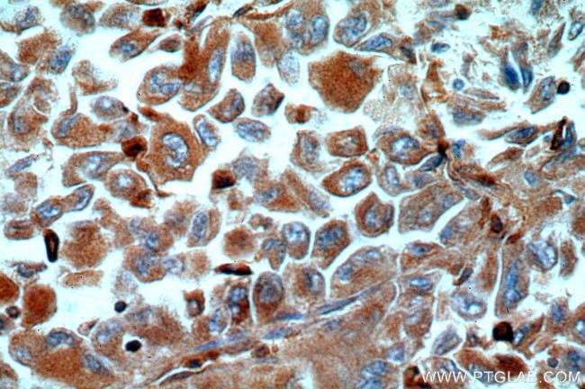 TGDS Antibody in Immunohistochemistry (Paraffin) (IHC (P))