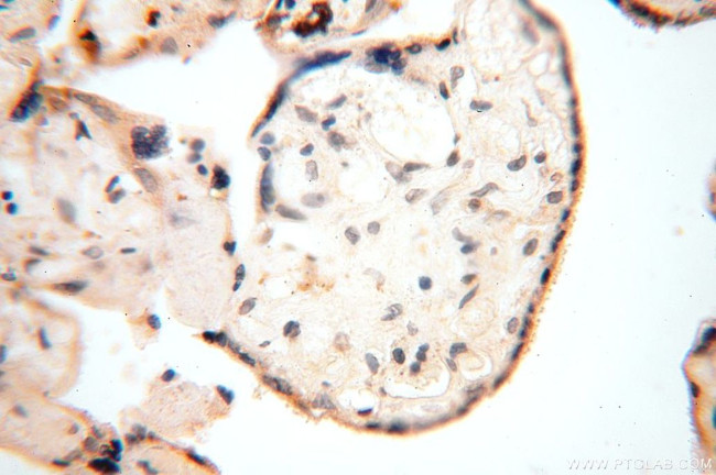 ERLIN1 Antibody in Immunohistochemistry (Paraffin) (IHC (P))