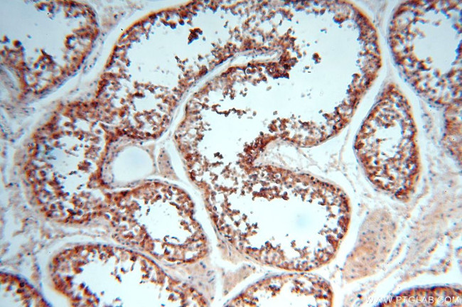 ERLIN1 Antibody in Immunohistochemistry (Paraffin) (IHC (P))