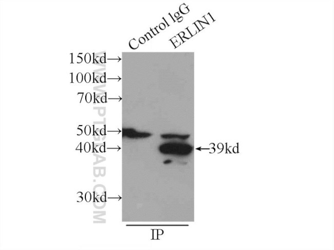 ERLIN1 Antibody in Immunoprecipitation (IP)