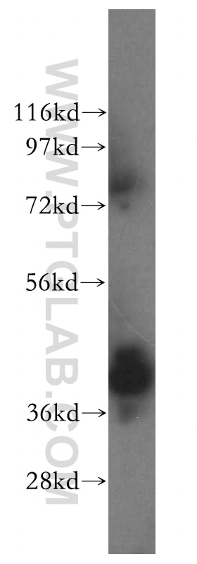 ERLIN1 Antibody in Western Blot (WB)