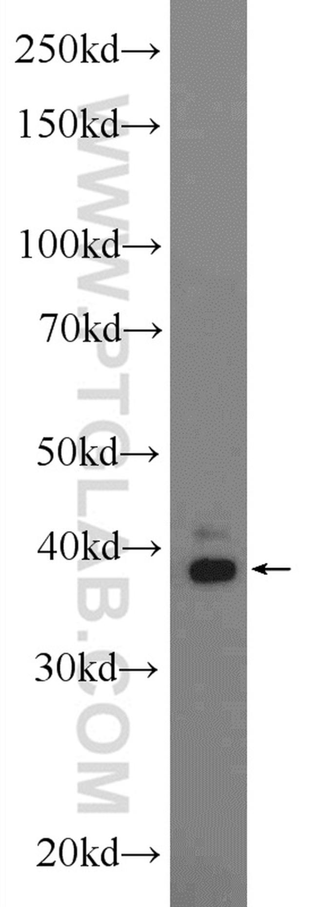 ERLIN1 Antibody in Western Blot (WB)