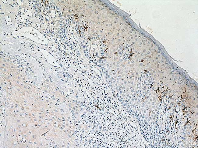 CD1a Antibody in Immunohistochemistry (Paraffin) (IHC (P))