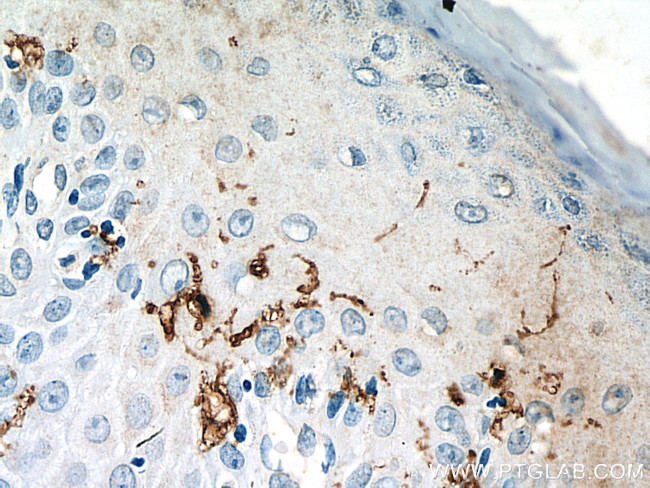 CD1a Antibody in Immunohistochemistry (Paraffin) (IHC (P))