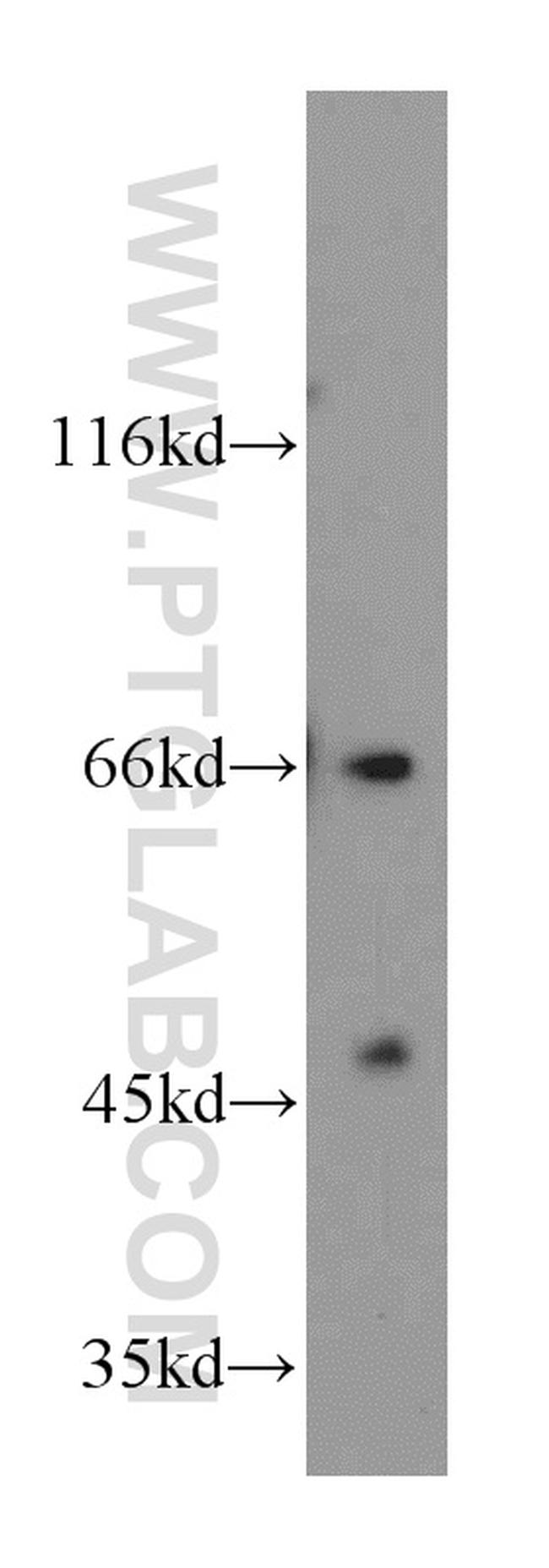 CD1a Antibody in Western Blot (WB)