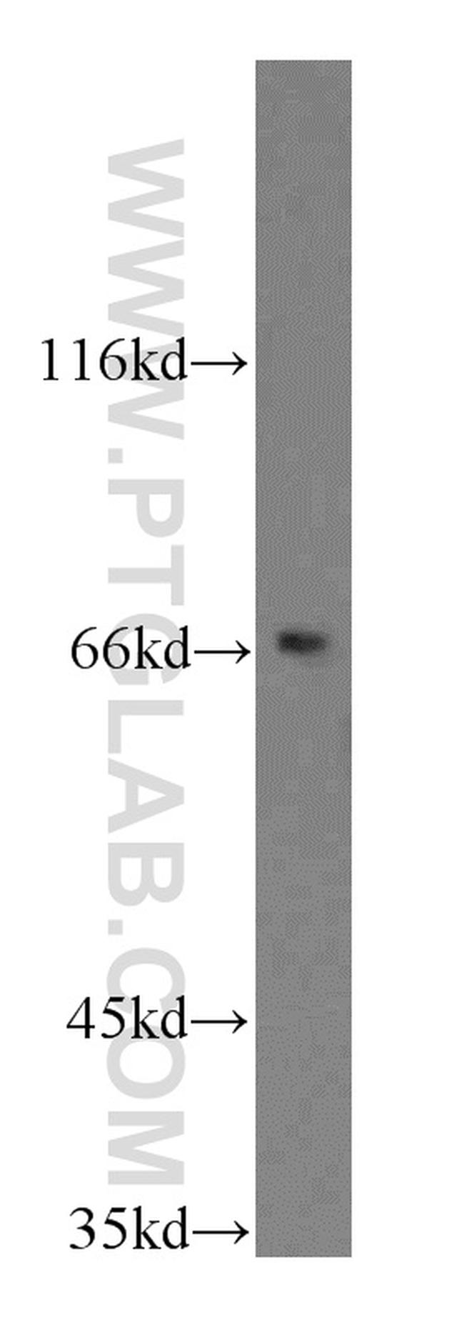 CD1a Antibody in Western Blot (WB)