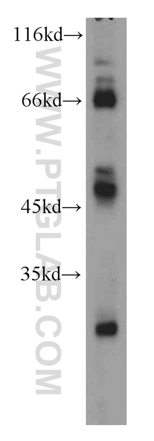 CD1a Antibody in Western Blot (WB)