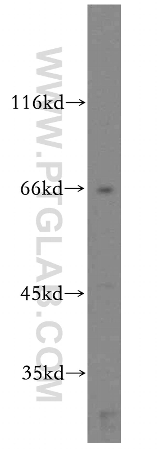 CD1a Antibody in Western Blot (WB)