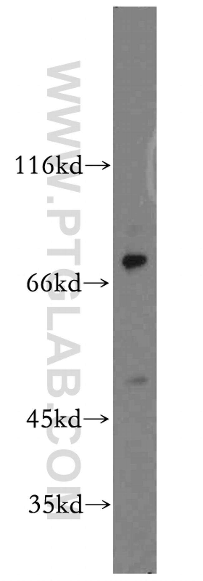 CD1a Antibody in Western Blot (WB)