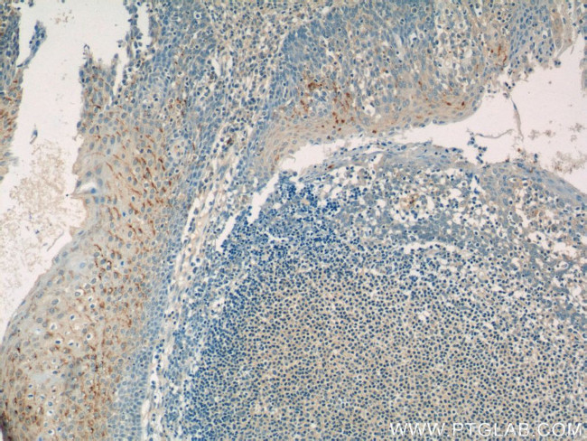 GSG1L Antibody in Immunohistochemistry (Paraffin) (IHC (P))