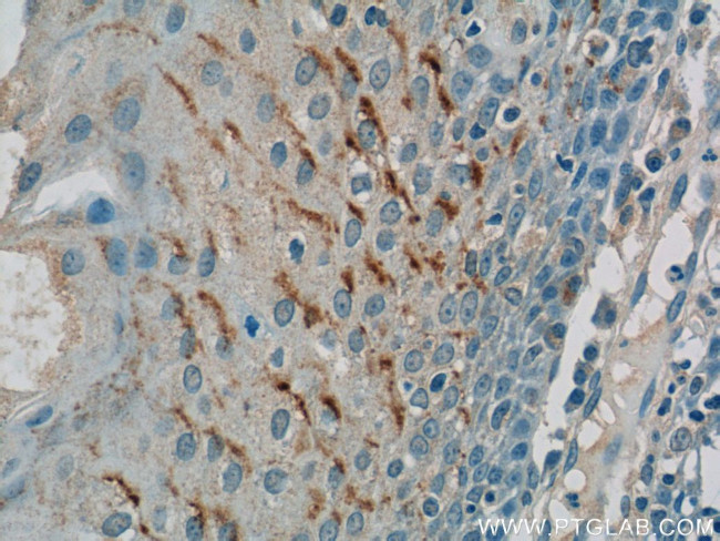 GSG1L Antibody in Immunohistochemistry (Paraffin) (IHC (P))