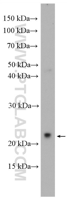 GSG1L Antibody in Western Blot (WB)