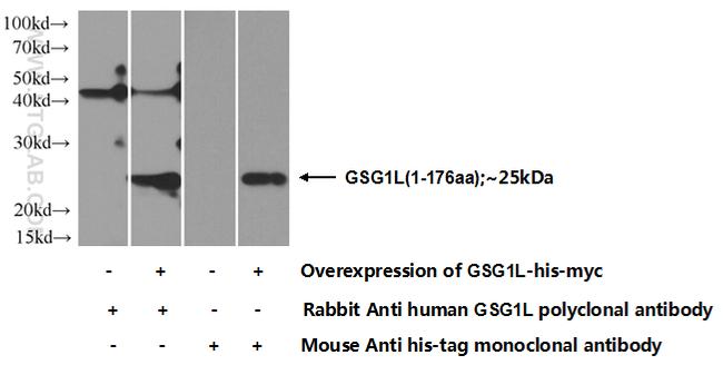 GSG1L Antibody in Western Blot (WB)