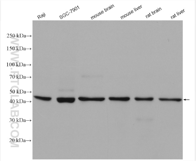 GSG1L Antibody in Western Blot (WB)