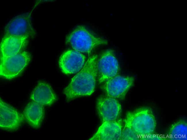 Cytokeratin 20 Antibody in Immunocytochemistry (ICC/IF)