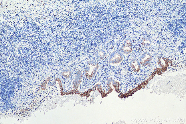 Cytokeratin 20 Antibody in Immunohistochemistry (Paraffin) (IHC (P))