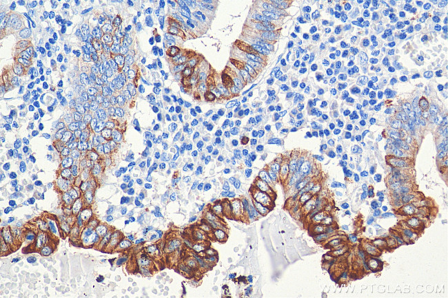 Cytokeratin 20 Antibody in Immunohistochemistry (Paraffin) (IHC (P))