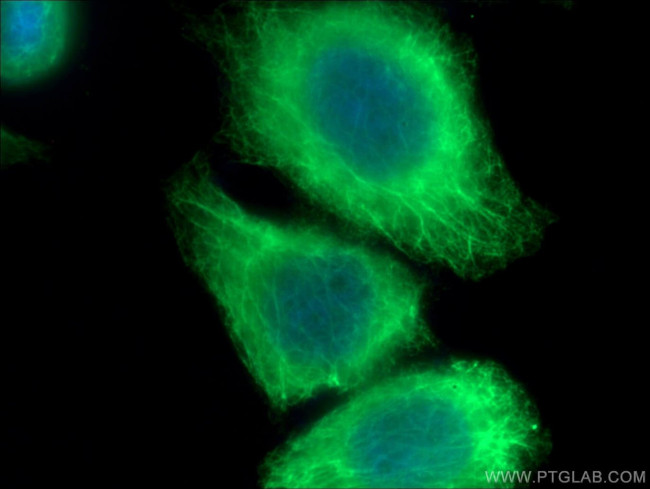 Cytokeratin 20 Antibody in Immunocytochemistry (ICC/IF)