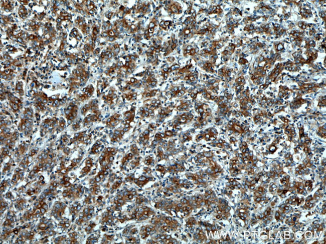 Cytokeratin 20 Antibody in Immunohistochemistry (Paraffin) (IHC (P))