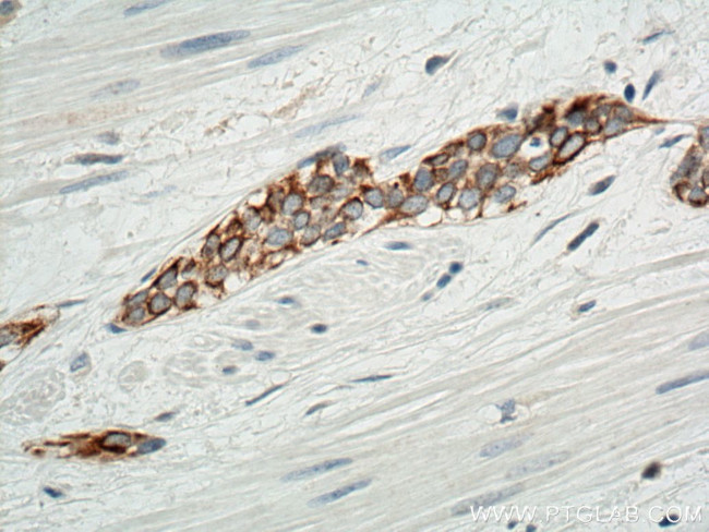 Cytokeratin 20 Antibody in Immunohistochemistry (Paraffin) (IHC (P))