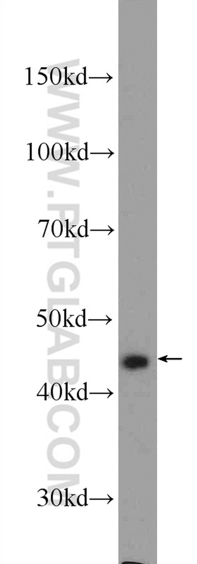 Cytokeratin 20 Antibody in Western Blot (WB)